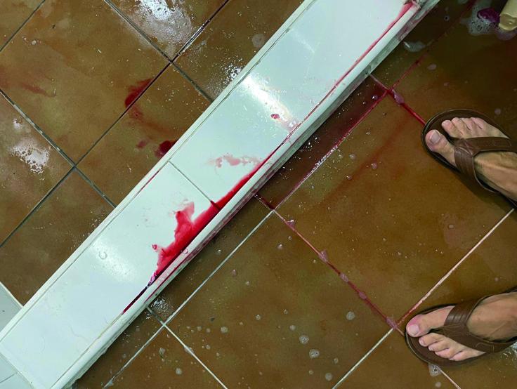 Un niño sufre herida de gravedad durante la celebración del Futsal Cup en Cádiz