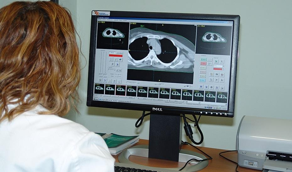 Aplican la Inteligencia Artificial para predecir posibles recaídas en pacientes con cáncer