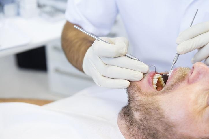 Un estudio revela que la periodontitis podría aumentar el riesgo de cáncer colorrectal