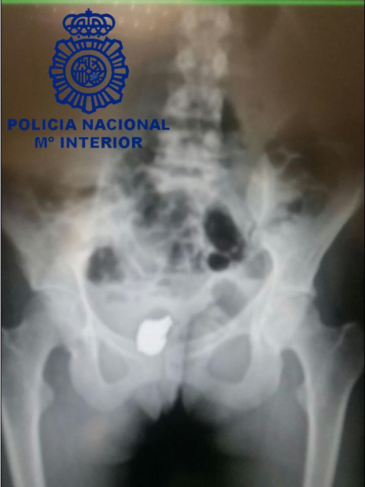Joyas en la vagina DGP